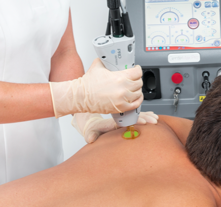 Epilation laser dos homme