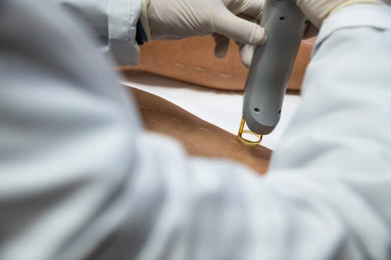 A partir de quel age commencer l'épilation laser - Dermo Laser Strasbourg