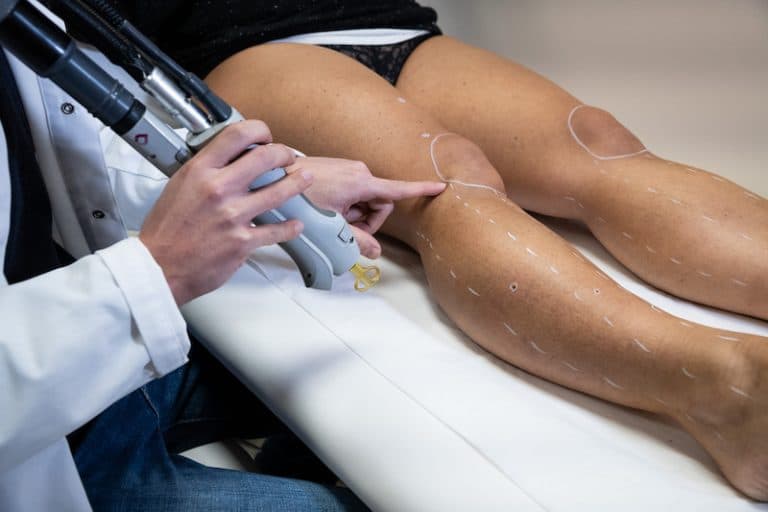 Combien de séances pour une épilation laser - Dermo Laser Strasbourg