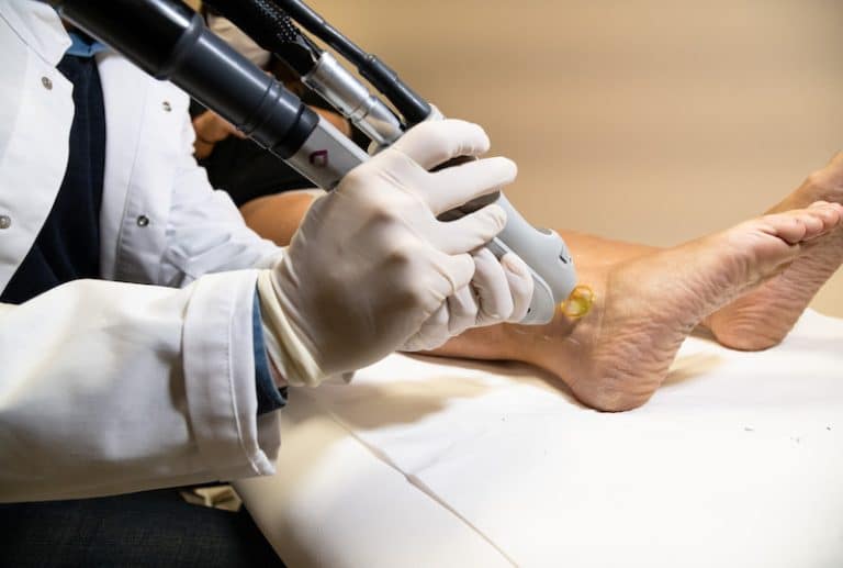 Dermo Laser Strasbourg - L'épilation laser est-elle douloureuse ?