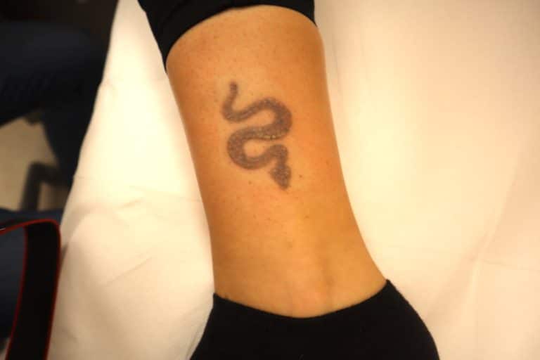 Combien de temps attendre avant de retirer un tatouage récent ? - Dermo Laser Strasbourg