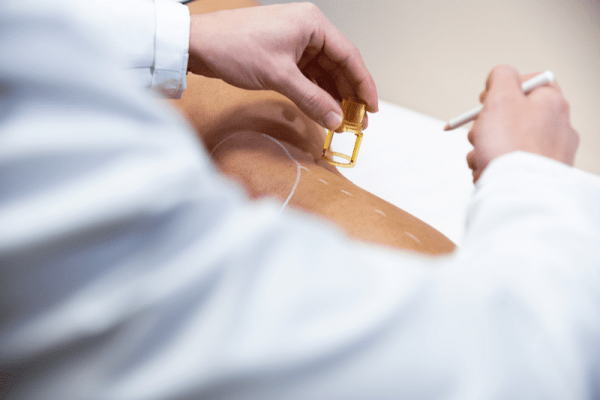 4-avantages-à-choisir-lépilation-laser-dans-un-centre-médical-à-Lyon-Dermo-Laser.png